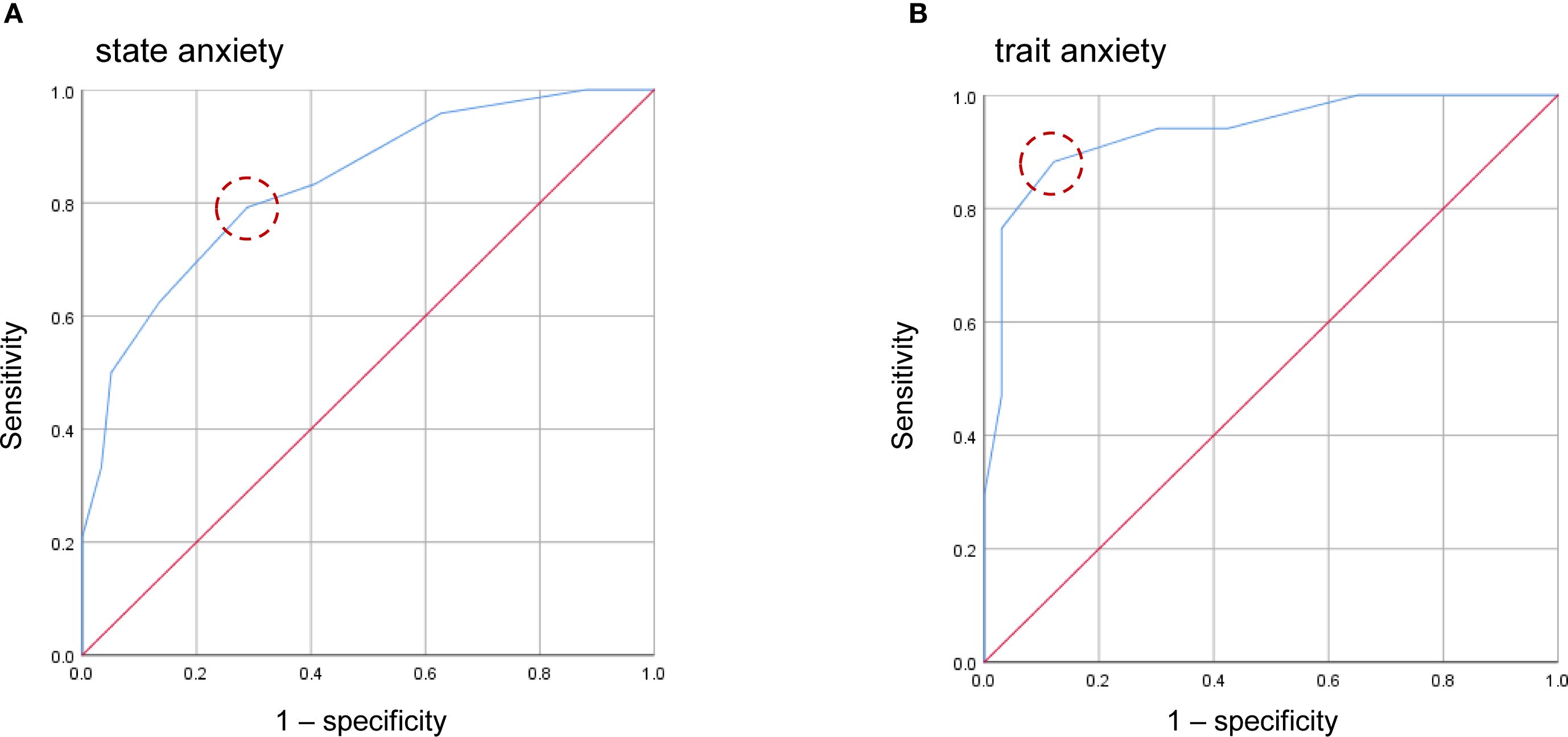 Receiver operating characteristic (ROC) curves for state anxiety (A) and trait anxiety (B). Each plot displays sensitivity against one minus specificity, with a blue curve for data points and a red diagonal line indicating no discrimination. A red dashed circle marks a key area on each curve.