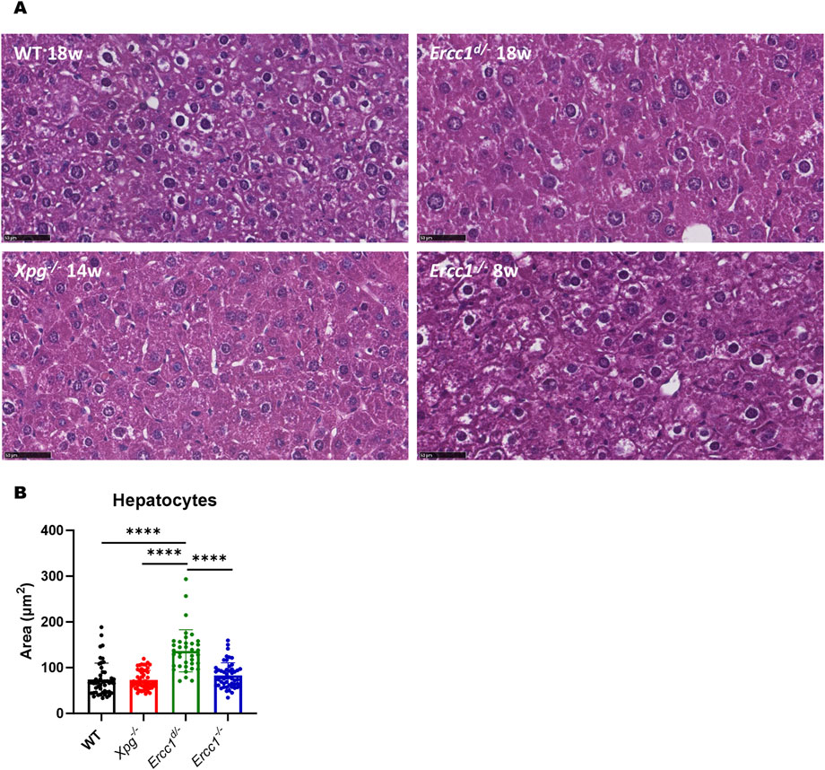 Panel A shows histological images of liver tissue from four groups: WT at 18 weeks, Ercc1 d/− at 18 weeks, Xpg−/− at 14 weeks, and Ercc1−/− at 8 weeks. The cells are stained to visualize cellular structures. Panel B presents a bar graph comparing hepatocyte area among these groups, with significant differences indicated.