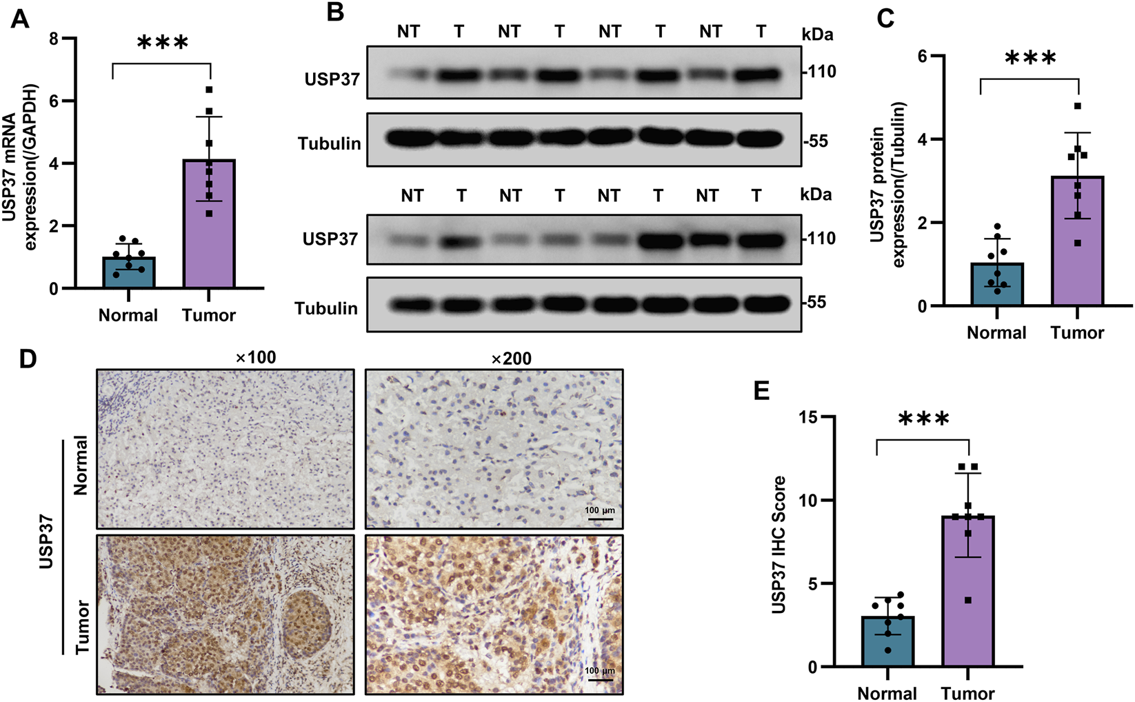 Five-panel image showing USP37 expression comparisons between normal and tumor samples. Panel A: Bar graph indicating higher USP37 mRNA expression in tumors. Panel B: Western blot images displaying increased USP37 protein in tumor samples. Panel C: Bar graph confirming elevated USP37 protein expression in tumors. Panel D: Immunohistochemistry images highlighting stronger USP37 staining in tumor tissues compared to normal. Panel E: Bar graph showing a higher USP37 IHC score in tumors. Asterisks denote statistical significance.