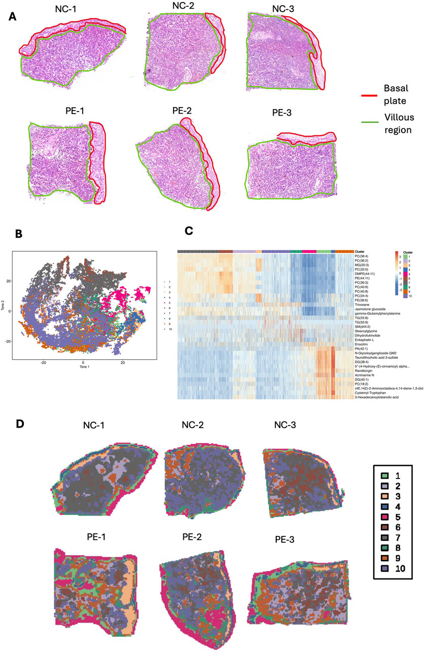 Panel A shows tissue samples NC-1, NC-2, NC-3, PE-1, PE-2, and PE-3 with basal plates outlined in red and villous regions in green. Panel B presents a scatter plot with clusters. Panel C depicts a heatmap with color-coded clusters. Panel D shows the same tissue samples with varied color patterns matching a legend indicating ten cluster types.