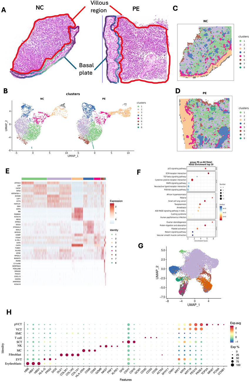 Composite image illustrating various biological data analyses. Panel A shows histological sections labeled NC and PE, highlighting villous region and basal plate. Panels B, C, and D display UMAP plots of data clusters differentiated by color. Panel E presents a heatmap of gene expression with varying intensity. Panel F is a dot plot of KEGG enrichment for pathways, with significance and enrichment score. Panel G features another UMAP for data distribution. Panel H shows a dot plot correlating features with identity, represented by color and dot size.