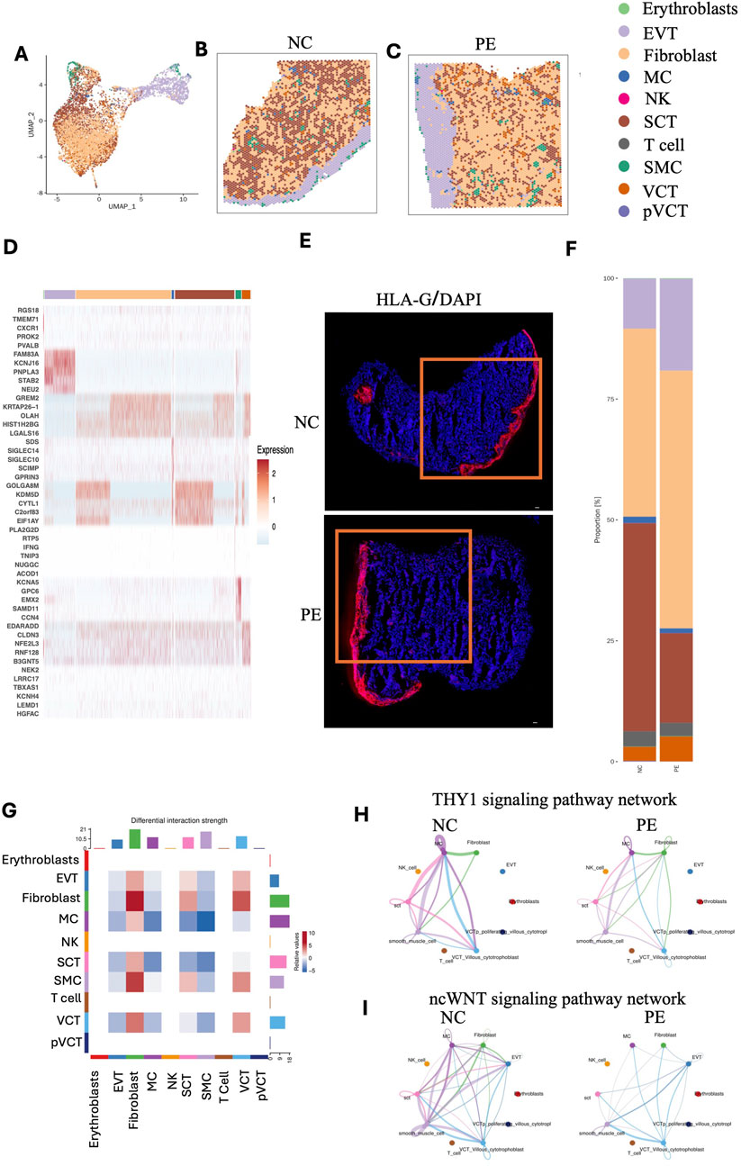 A multi-panel scientific figure includes:A. UMAP visualization of cell types with a color-coded legend for various cell types like erythroblasts and fibroblasts.B and C. Enlarged sections labeled NC and PE with detailed cell distribution.D. Heatmap showing gene expression levels across different samples.E. Imaging of HLA-G/DAPI in NC and PE, indicative of cellular structures.F. Bar chart depicting percentage distribution of cell types.G. Differential interaction strength matrix among cell types.H and I. Network diagrams of THY1 and ncWNT signaling pathways for NC and PE.