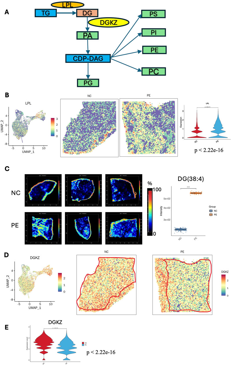 Diagram illustrating lipid metabolic pathways and gene expression analysis. Panel A shows a pathway starting with TG to PC, detailing enzymes and compounds like LPL and DGKZ. Panels B and D display UMAP plots with density visualizations for LPL and DGKZ expression, comparing NC and PE tissues. Panels C and E present heatmaps and violin plots illustrating the expression levels and significance, with significant p-values noted.