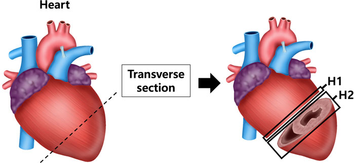 Illustration of a heart showing a transverse section. The heart is cut diagonally, revealing inner structures. Labels indicate sections H1 and H2. An arrow points from the whole heart to the sectioned view.