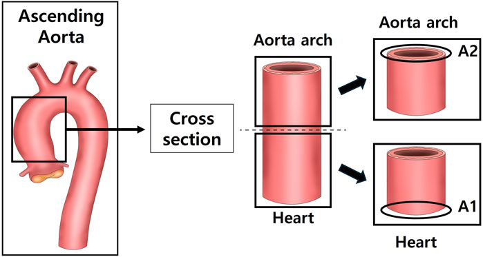 Diagram showing the ascending aorta with a highlighted section labeled for cross-sectional viewing. A cylindrical cross-section is shown, indicating parts of the aorta arch and heart. The sections A2 and A1 are labeled, highlighting the aorta arch and heart, respectively.