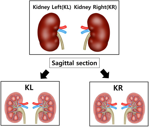 Diagram showing the external view of a left and right kidney. Below, sagittal sections of each kidney highlight internal structures with labels