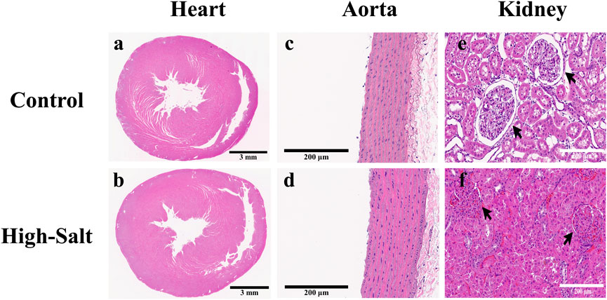 Histological comparison of heart, aorta, and kidney tissues under control and high-salt conditions. Images a and b show heart cross-sections; images c and d depict aorta sections; images e and f display kidney tissues. Tissues are stained to highlight structural differences. Arrows in kidney images indicate specific features or changes. Scale bars provide reference for size.