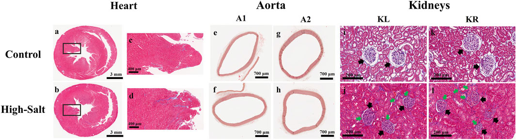Histological comparison of heart, aorta, and kidney tissues in control and high-salt groups. Panels a-d show heart sections with notable tissue structure differences. Panels e-h depict aorta sections with varying wall thickness. Panels i-l illustrate kidney sections, highlighting glomeruli and altered architecture. Scale bars indicate magnification levels for precise observation.