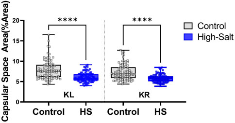 Box plot comparing capsular space area percentages under control and high-salt conditions for KL and KR groups. Control groups show higher capsular space areas than high-salt groups. Significant differences are marked by asterisks. Control is gray, high-salt is blue.