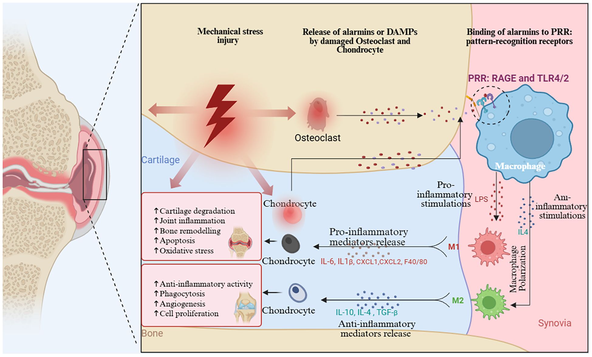 Diagram illustrating the response to mechanical stress injury in cartilage. It shows that damaged osteoclasts and chondrocytes release alarmins or DAMPs. These bind to pattern-recognition receptors (PRR) on macrophages, influencing pro-inflammatory (red arrows) or anti-inflammatory (blue arrows) stimulants. Chondrocytes release mediators like IL-6 and IL-10, affecting joint inflammation and bone remodeling. Macrophage polarization into M1 and M2 types is shown, along with effects on cartilage degradation and other inflammatory responses. The visual includes detailed pathways of cellular interactions within a joint section.
