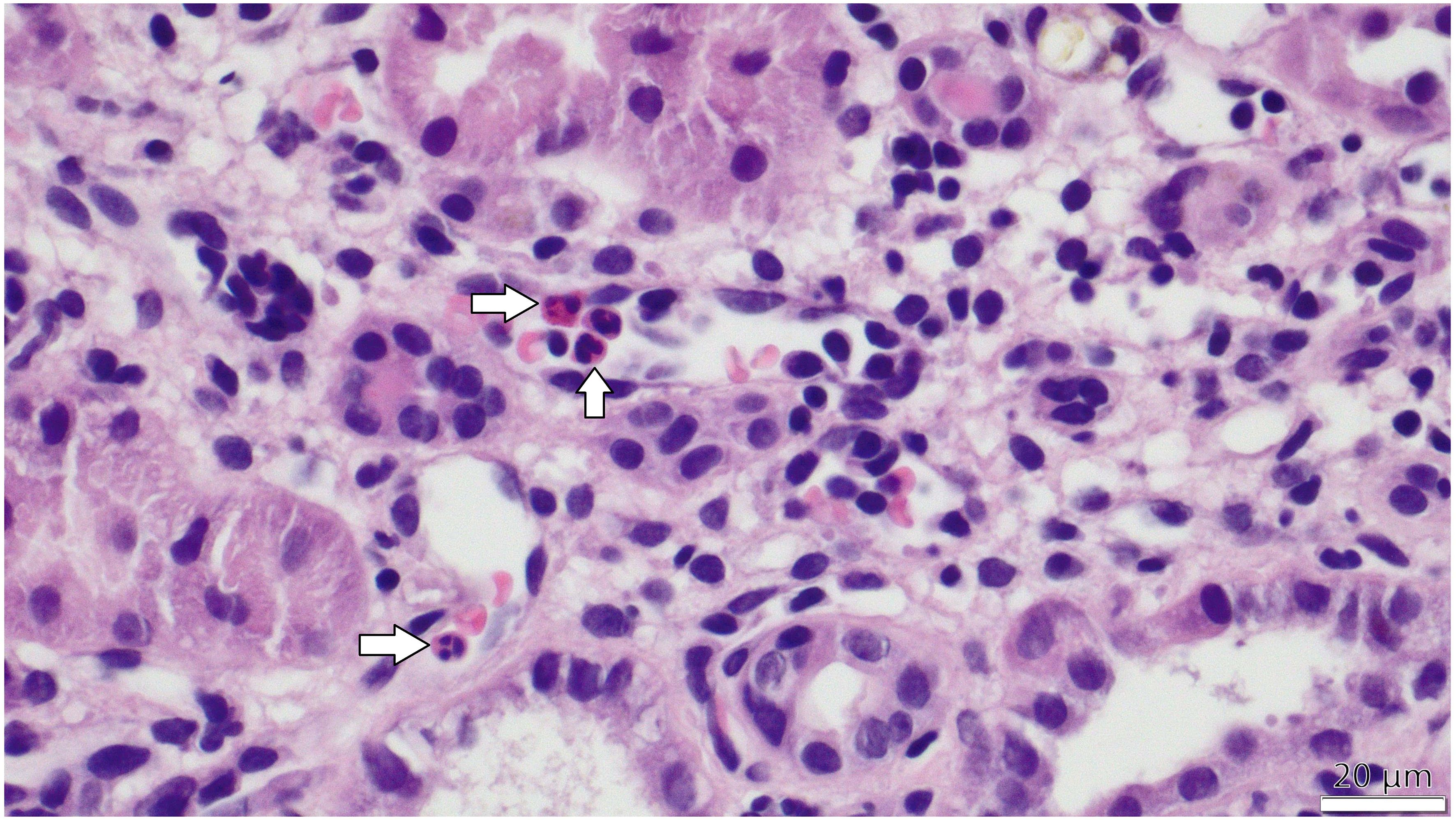Histological image showing pink and purple stained tissue with numerous scattered cells. White arrows point to specific areas containing darker-stained cells, possibly indicating a focus of interest or abnormal activity. Scale bar measures twenty micrometers.