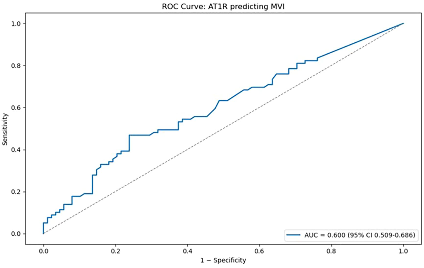 ROC curve illustrating AT1R predicting MVI with sensitivity on the y-axis and 1-specificity on the x-axis. The curve shows an Area Under the Curve (AUC) of 0.600 with a 95% confidence interval of 0.509 to 0.686. A dashed diagonal line indicates the line of no discrimination.