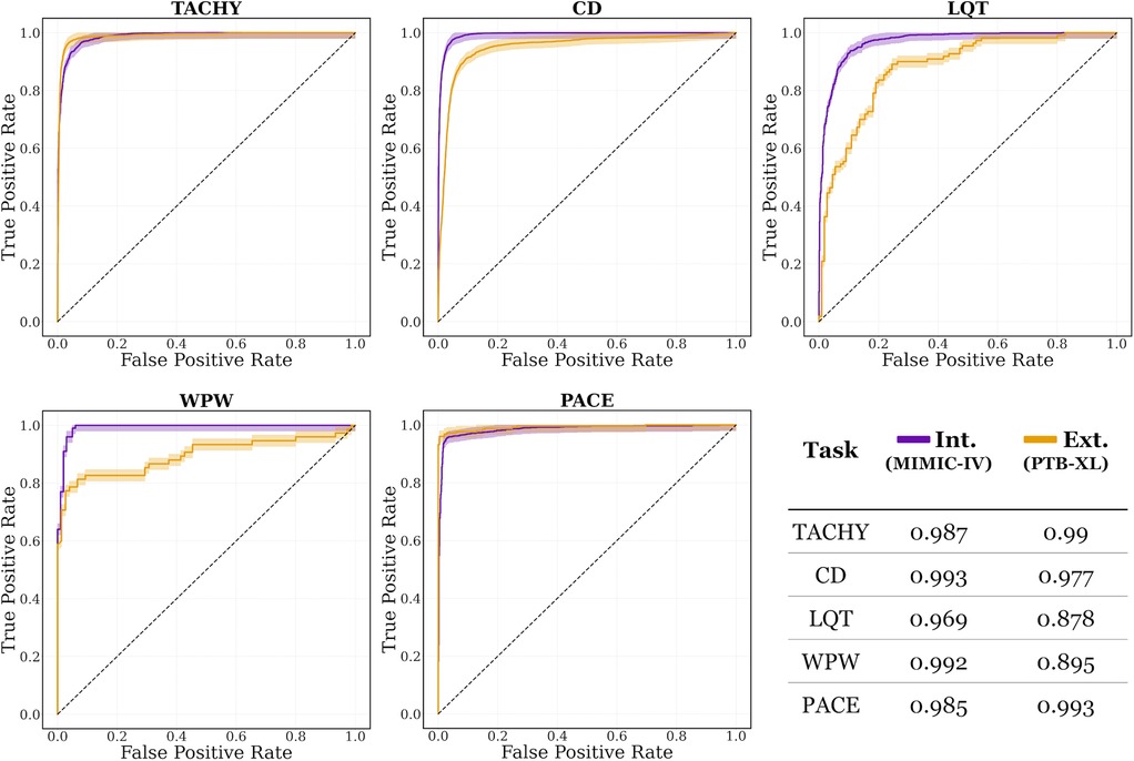 Five ROC curves compare models' performance on TACHY, CD, LQT, WPW, and PACE tasks. Purple and orange lines represent internal (MIMIC-IV) and external (PTB-XL) datasets. A table shows respective AUC scores: TACHY 0.987/0.99, CD 0.993/0.977, LQT 0.969/0.878, WPW 0.992/0.895, and PACE 0.985/0.993. True Positive Rate is plotted against False Positive Rate.