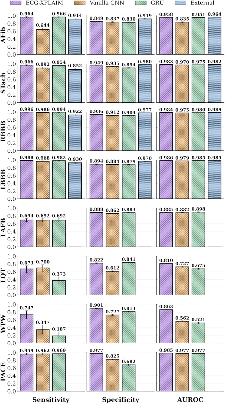 Bar graph comparing the performance of ECG-XPLAIM, a vanilla CNN, a GRU, and an external model in diagnosing cardiac conditions. Performance metrics include Sensitivity, Specificity, and AUROC for conditions like AFib, Stach, RBBB, LBBB, LAFB, LQT, WPW, and PACE. Each model's metric is represented with colored bars: ECG-XPLAIM (purple), Vanilla CNN (orange), GRU (green), and external model (blue). Numerical values above each bar indicate the performance score for that metric and condition.