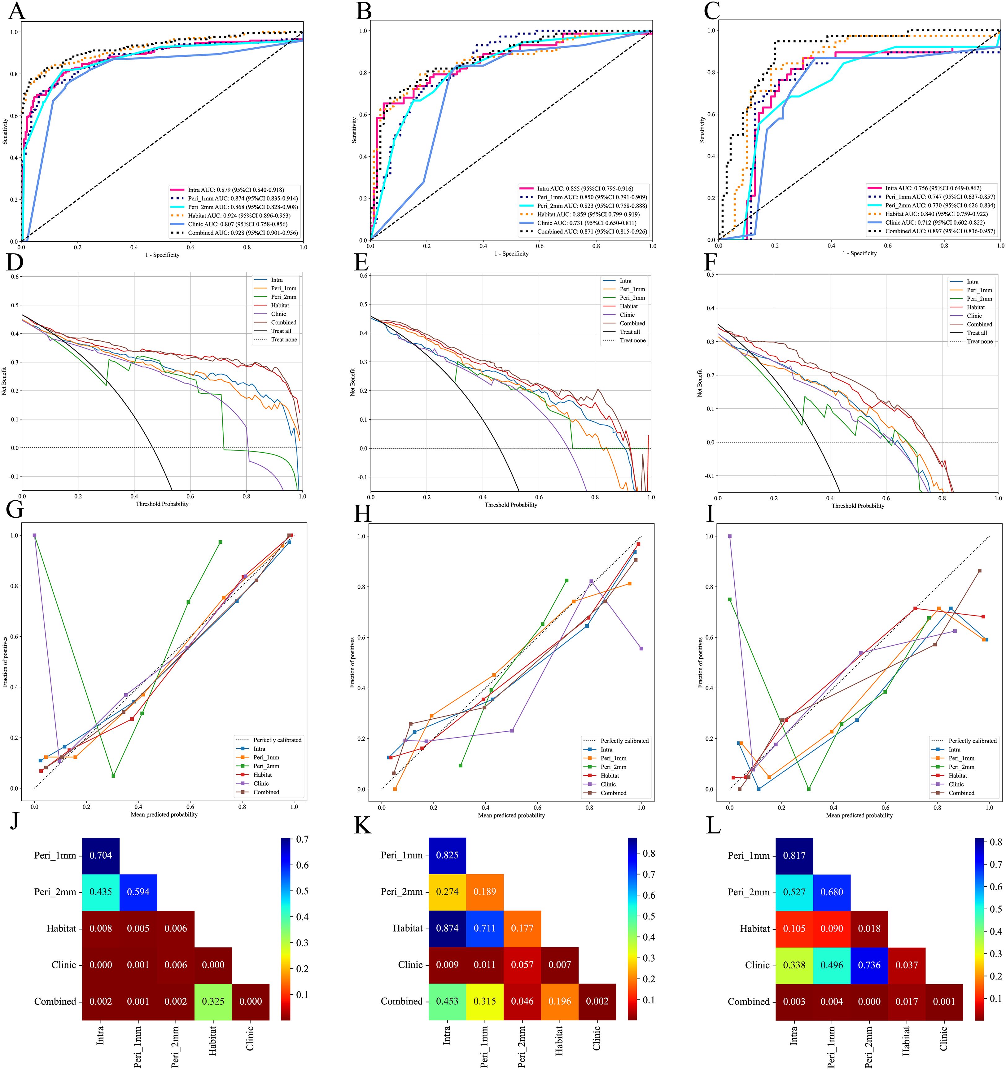 Nine-panel scientific figure showing graphs A to L analyzing predictive models. Panels A, B, C display ROC curves with varying AUC values for different models, indicating model performance. Panels D, E, F show decision curves, presenting net benefits across threshold probabilities. Panels G, H, I illustrate calibration plots comparing predicted vs. observed probabilities, evaluating model accuracy. Panels J, K, L consist of color-coded tables with performance metrics for different prediction methods, including Peri, Habitat, Clinic, and Combined. Each panel contributes to assessing model effectiveness through different statistical visualizations.