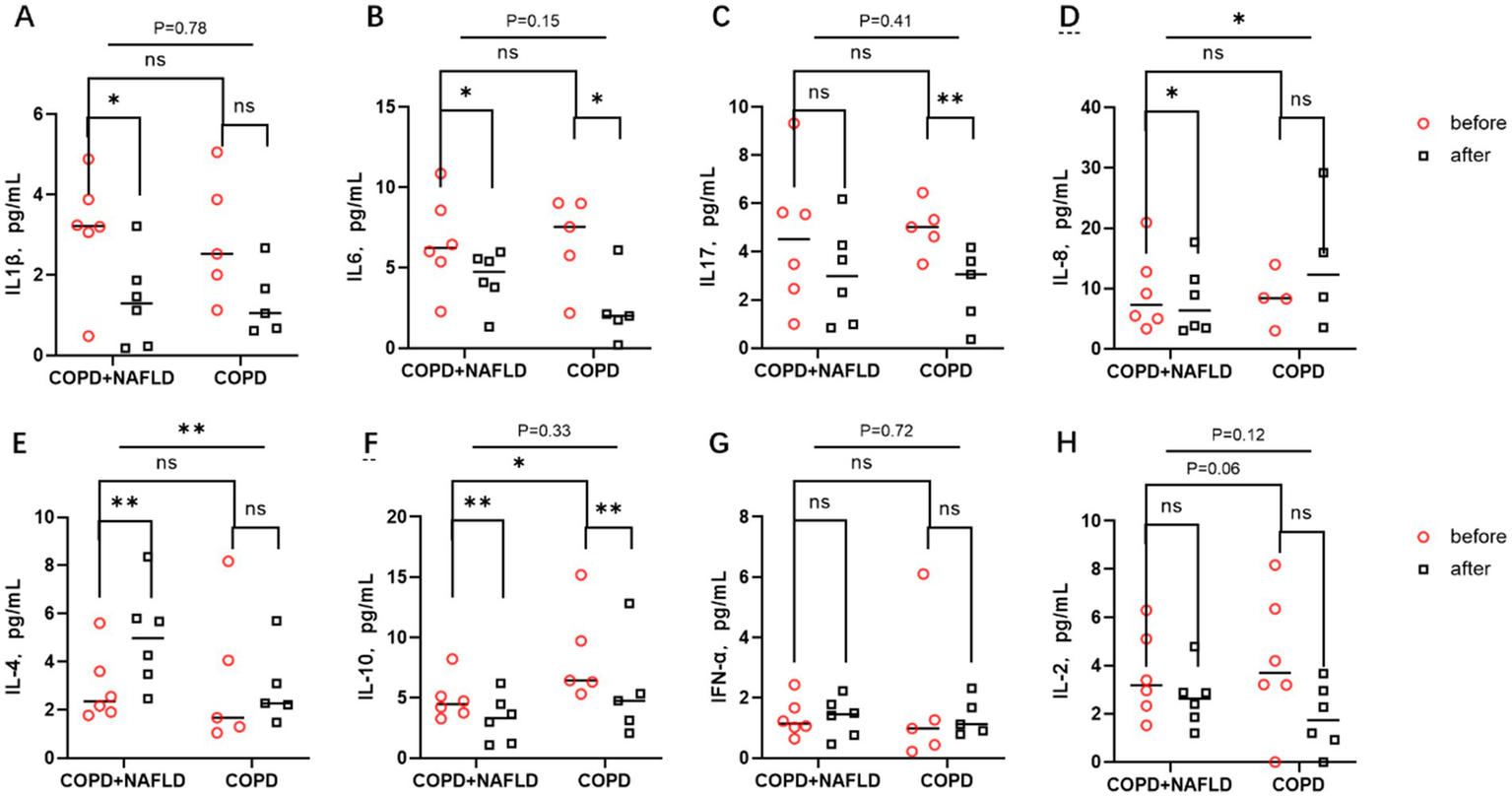 Graphs A to H present cytokine levels in COPD and COPD+NAFLD patients before and after treatment. Graphs compare IL-1β, IL-6, IL-17, IL-8, IL-4, IL-10, IFN-α, and IL-2 levels. Significant differences and p-values are indicated. Red circles show levels before, and black squares show levels after treatment.