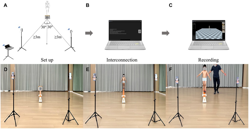 Diagram illustrating a motion capture setup and process. (A) Shows the setup with cameras positioned over three meters apart at 30-degree angles to a checkerboard target. (B) Displays a laptop for interconnection, indicating software and QR code interface. (C) Represents the recording phase with software displaying a digital checkerboard. (D-F) Sequential photos show two smartphones on tripods capturing a scene: a child walks on a balance beam in a room, with an adult assisting in the final frame.