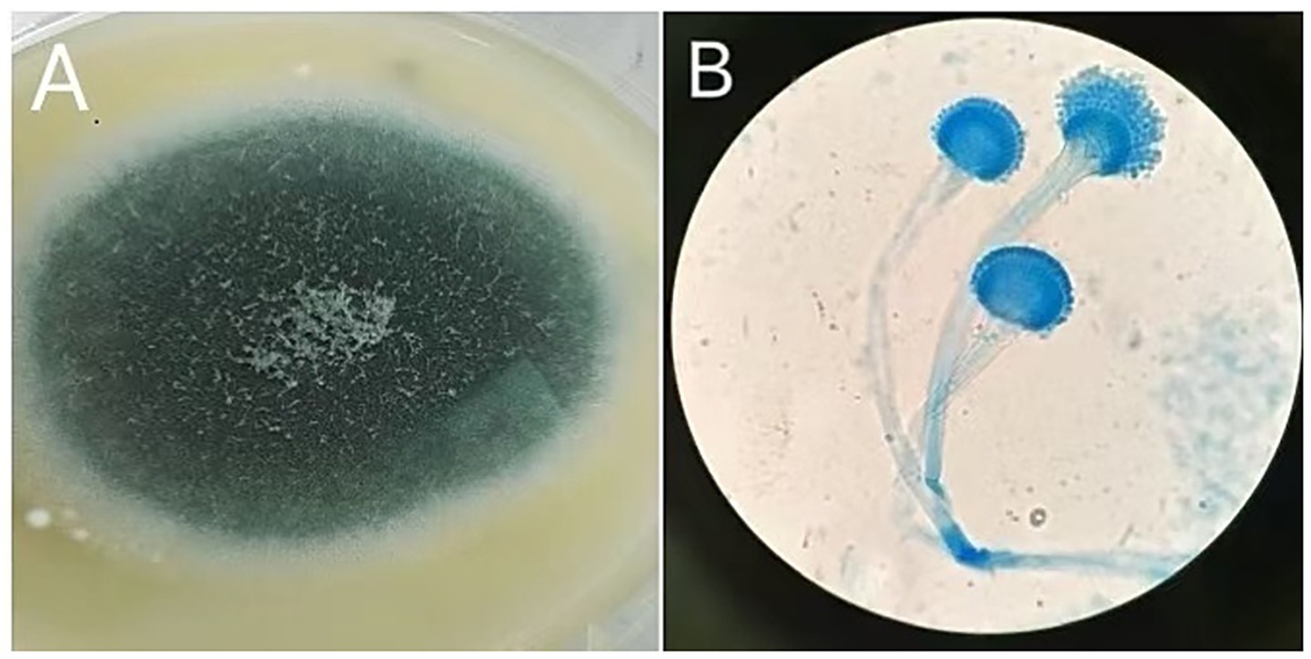 Panel A shows a dark green and white fuzzy fungal colony on a petri dish. Panel B displays a microscopic view of blue-stained conidiophores, structures associated with fungal spores, under magnification.