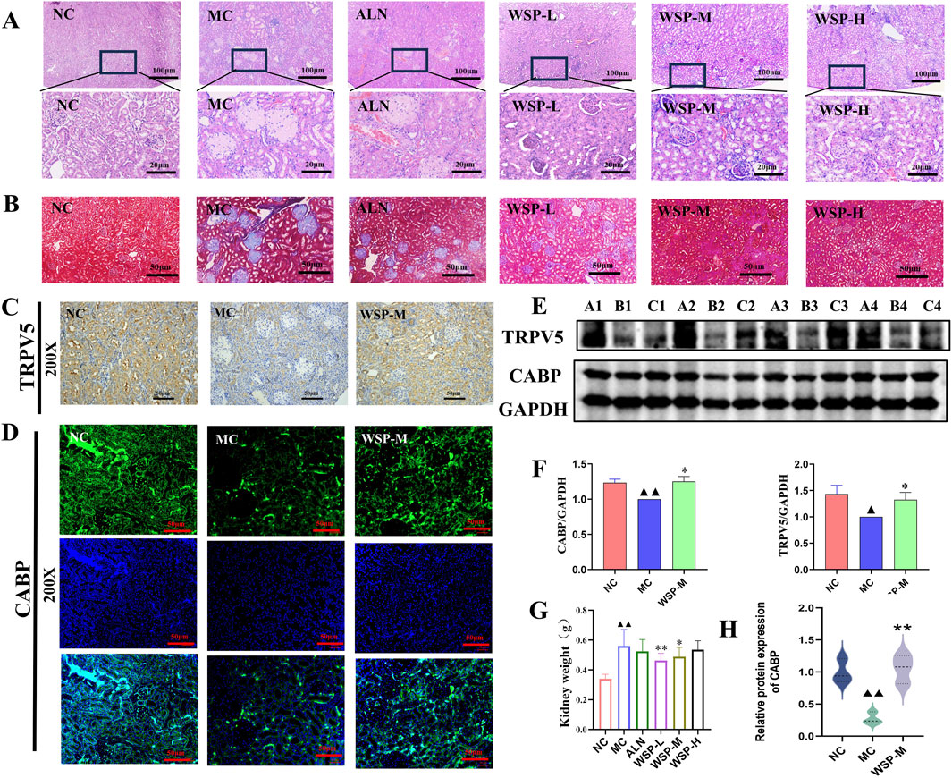 Panels show histological and biochemical analyses. A: Microscopic images of kidney tissues under different treatments labeled NC, MC, ALN, WSP-L, WSP-M, and WSP-H, with 100 μm and 20 μm scales. B: Enlarged images display kidney tissues with a 50 μm scale. C: Immunohistochemical staining for TRPV5 with a 200x magnification. D: Immunofluorescence for CABP, overlaid with DAPI, at 200x. E: Western blot bands for TRPV5, CABP, and GAPDH. F: Bar graphs comparing CABP/GAPDH and TRPV5/GAPDH ratios. G: Bar graph showing kidney weight. H: Violin plots for CABP protein expression.
