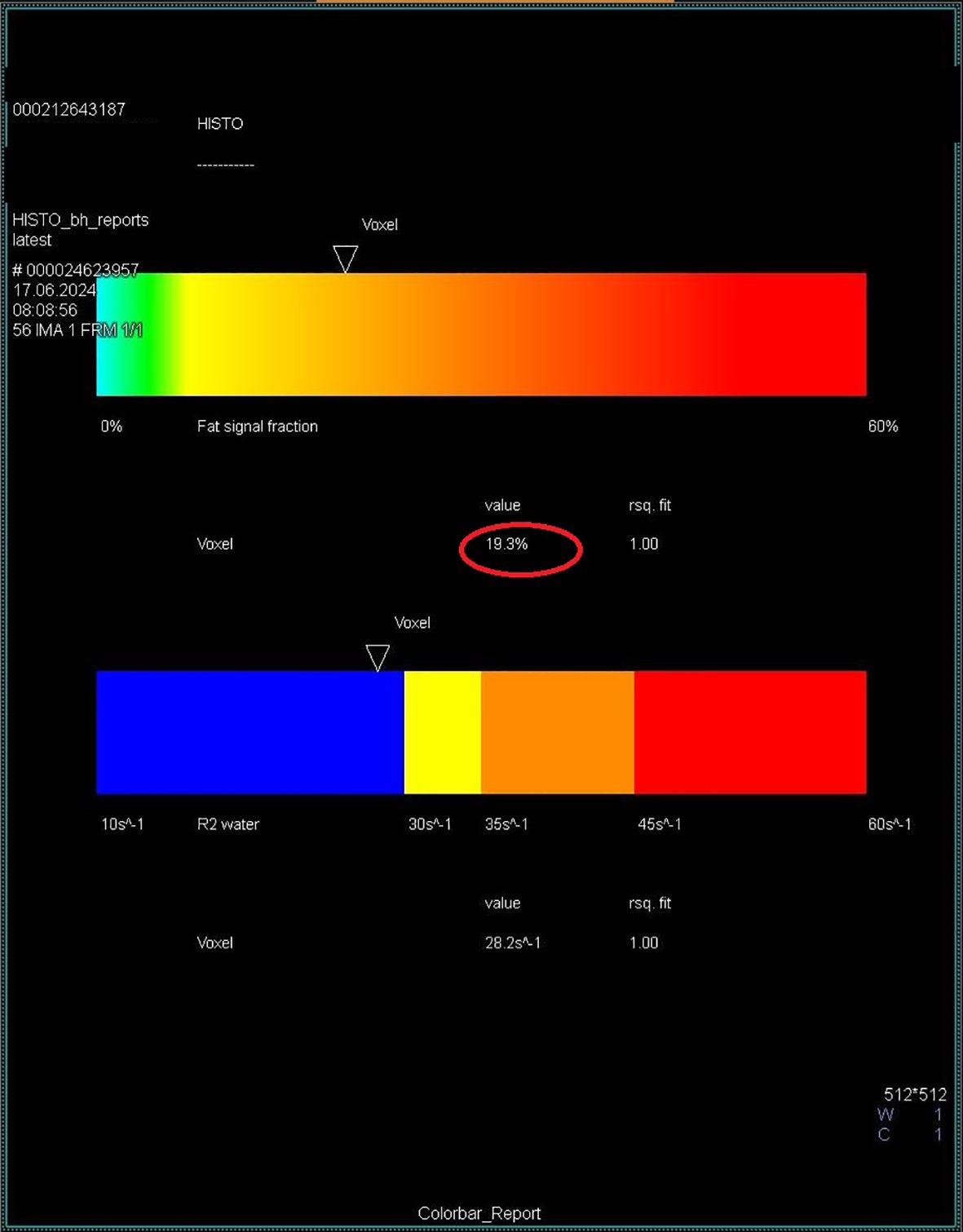 Color bar diagram displaying voxel data. The top bar shows fat signal fraction ranging from green at 0 percent to red at 60 percent, with a highlighted value of 19.3 percent. The bottom bar shows R2 water values in blue to red spectrum indicating various rates, with a key value of 28.2. Both bars indicate an rsq. fit of 1.00.