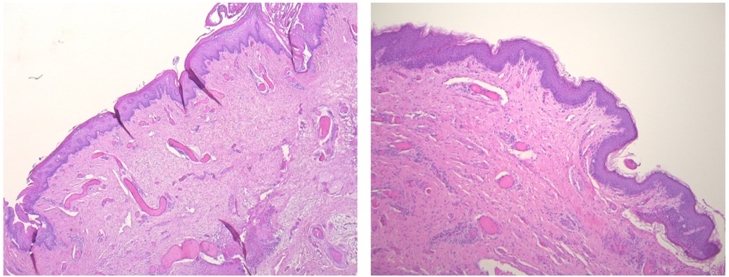 Microscopic images of skin tissue sections. The left panel shows a wavy pattern of dermal papillae, while the right panel displays a thicker, more uniform epidermis. Both images are stained with hematoxylin and eosin, highlighting cellular structures in shades of pink and purple.