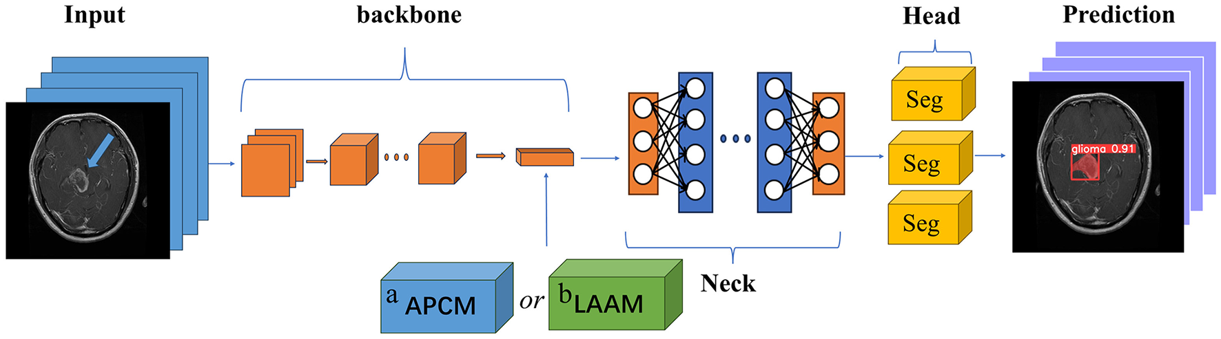 Diagram showing a medical imaging workflow for brain scan analysis. It begins with an input MRI image, passes through a backbone with multiple blocks, then through a neck with options labeled APCM or LAAAM. The head comprises segmentation layers, leading to a prediction output image highlighting a glioma with a confidence score of 0.91.