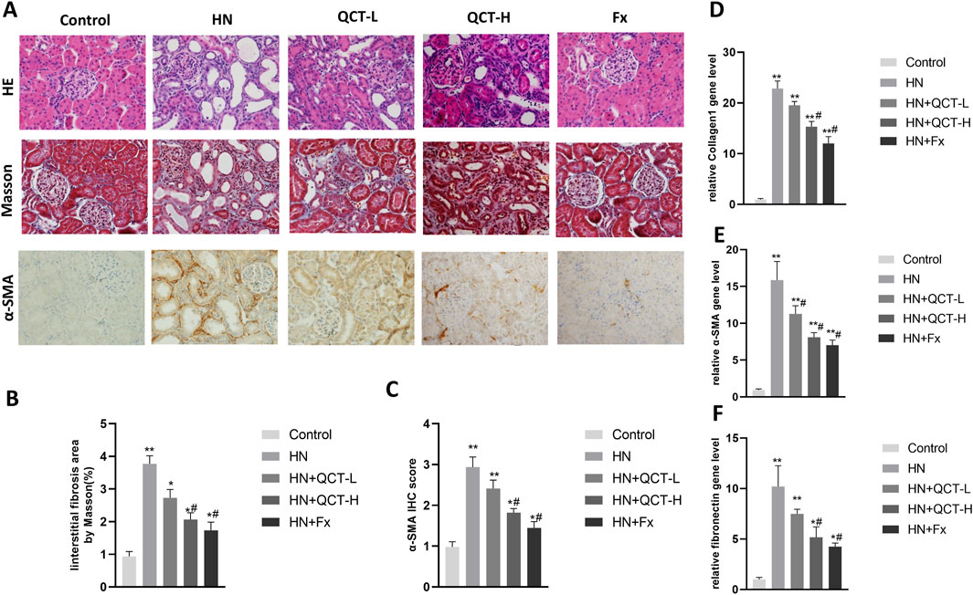 Microscopic images and bar graphs illustrate the effects of different treatments on kidney tissue. Panel A shows images stained with HE, Masson, and α-SMA for control, HN, QCT-L, QCT-H, and Fx groups, revealing varying levels of fibrosis and cellular changes. Panels B to F feature bar graphs comparing interstitial fibrosis area, α-SMA IHC score, and gene levels of collagen1, α-SMA, and fibronectin among the groups, indicating statistical significance with annotations.
