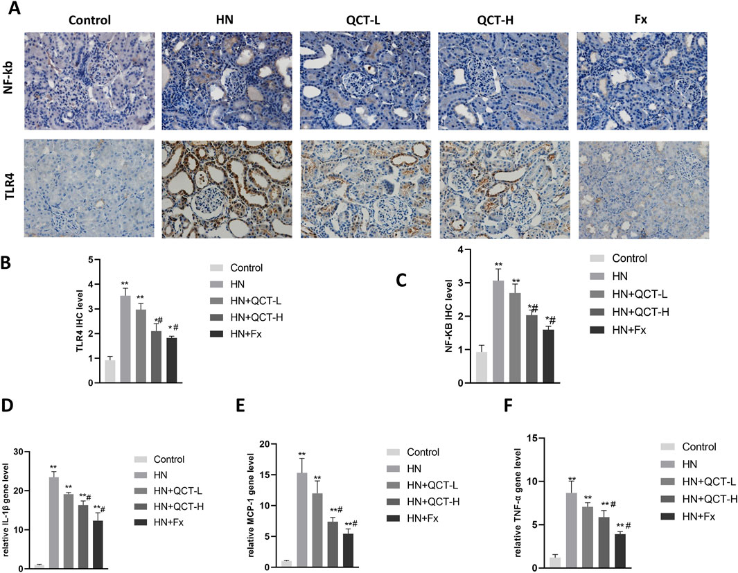 Histological images and bar graphs showing the effects of different treatments. Panel A presents NF-kB and TLR4 expression in tissue samples under five conditions: Control, HN, QCT-L, QCT-H, and Fx. Panels B to F display bar graphs comparing TLR4 IHC level, NF-kB IHC level, IL-1β gene level, MCP-1 gene level, and TNF-α gene level across these conditions, with statistical annotations indicating significance.