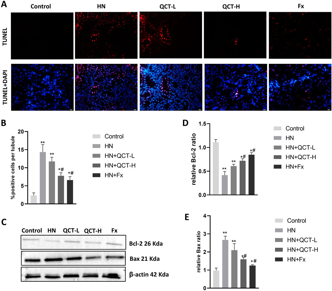 Panel A shows fluorescence microscopy images indicating TUNEL staining in six groups: Control, HN, QCT-L, QCT-H, and Fx. Panels B, D, and E display bar graphs comparing positive cells per tubule, relative Bcl-2 ratio, and relative Bax ratio among the groups. Panel C presents a Western blot analysis for proteins Bcl-2, Bax, and β-actin across the groups. Statistical significance is indicated by markers such as asterisks and hashtags.