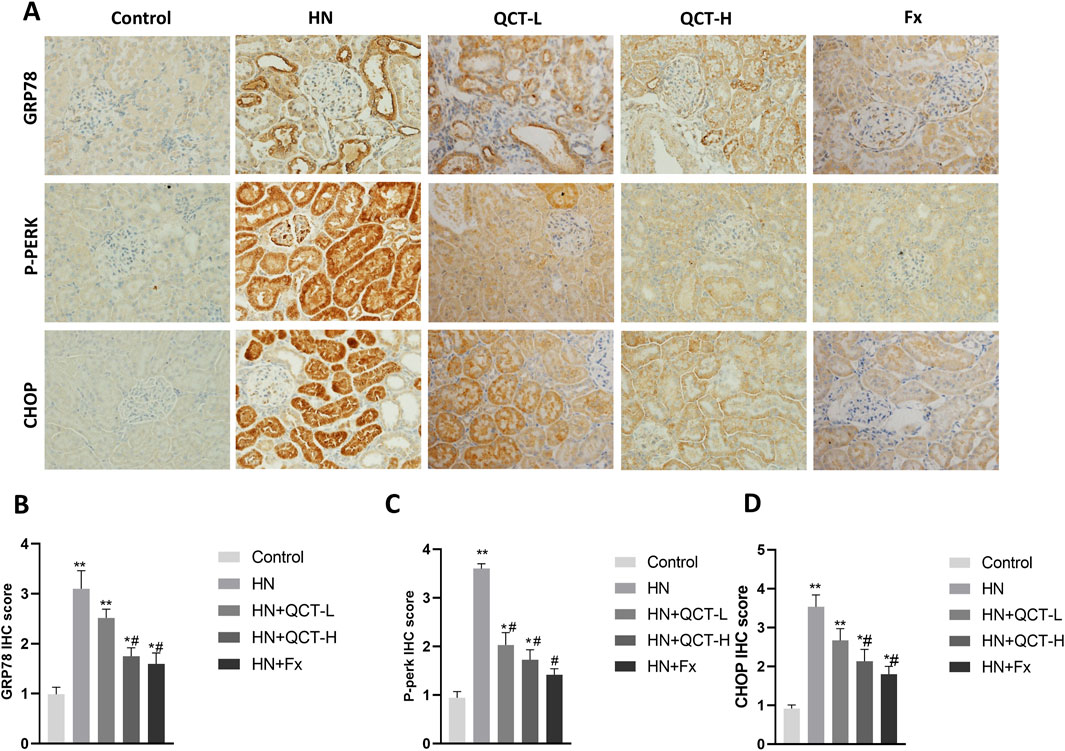 Panel A displays immunohistochemistry results for GRP78, P-PERK, and CHOP across different treatment groups: Control, HN, QCT-L, QCT-H, and Fx. Panels B, C, and D present bar graphs showing IHC scores for GRP78, P-PERK, and CHOP respectively, with significant differences marked by asterisks and hashtags.