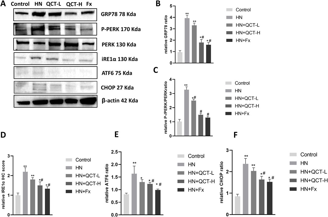 Western blot and bar graphs display protein expression and ratios across different samples: Control, HN, QCT-L, QCT-H, and Fx. Panel A shows protein bands for GRP78, P-PERK, PERK, iRE1α, ATF6, CHOP, and β-actin. Panels B to F present bar graphs for relative expression ratios and immunohistochemistry scores of GRP78, P-PERK/PERK, iRE1α, ATF6, and CHOP with varying intensity across treatments. Bar labels indicate Control, HN, HN+QCT-L, HN+QCT-H, and HN+Fx. Statistical significance is marked by asterisks and hashtags.