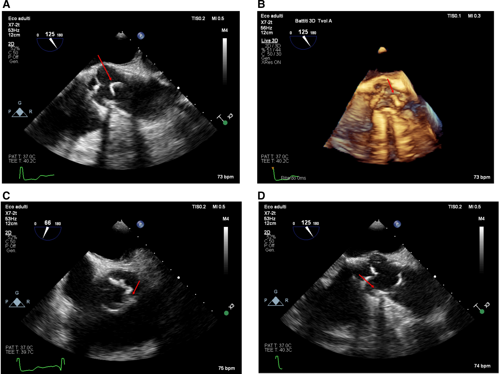 Four-panel ultrasound images showing heart scans. Each panel displays an echocardiogram with annotations and graphical elements like heart rate and temperature. Red arrows highlight specific areas in each scan. The top right image is a 3D view.