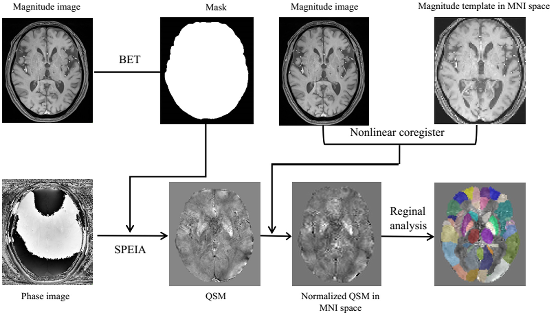 Flowchart illustrating a process involving brain imaging. It begins with a magnitude and phase image. The magnitude image undergoes BET to produce a mask, which is followed by non-linear coregistering with an MNI space template. Parallelly, the phase image transforms into QSM through SPEIA, then normalizes in MNI space. The final step is regional analysis, producing a color-coded brain map.