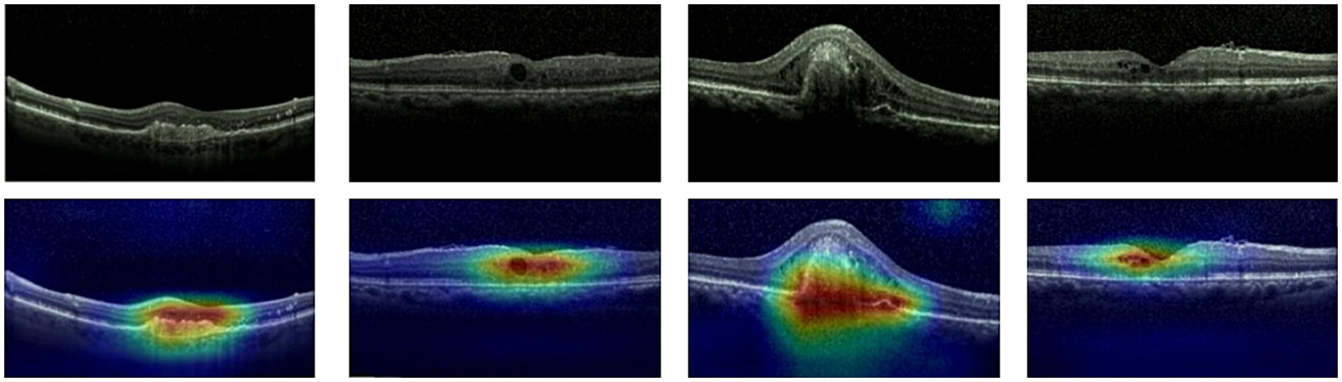 A series of eight ocular images, showing two rows of Optical Coherence Tomography (OCT) scans. The top row features four black and white scans displaying eye structures with varying shapes. The bottom row presents corresponding color-enhanced images, highlighting areas of interest in red, yellow, green, and blue shades, indicating different intensities or depths.