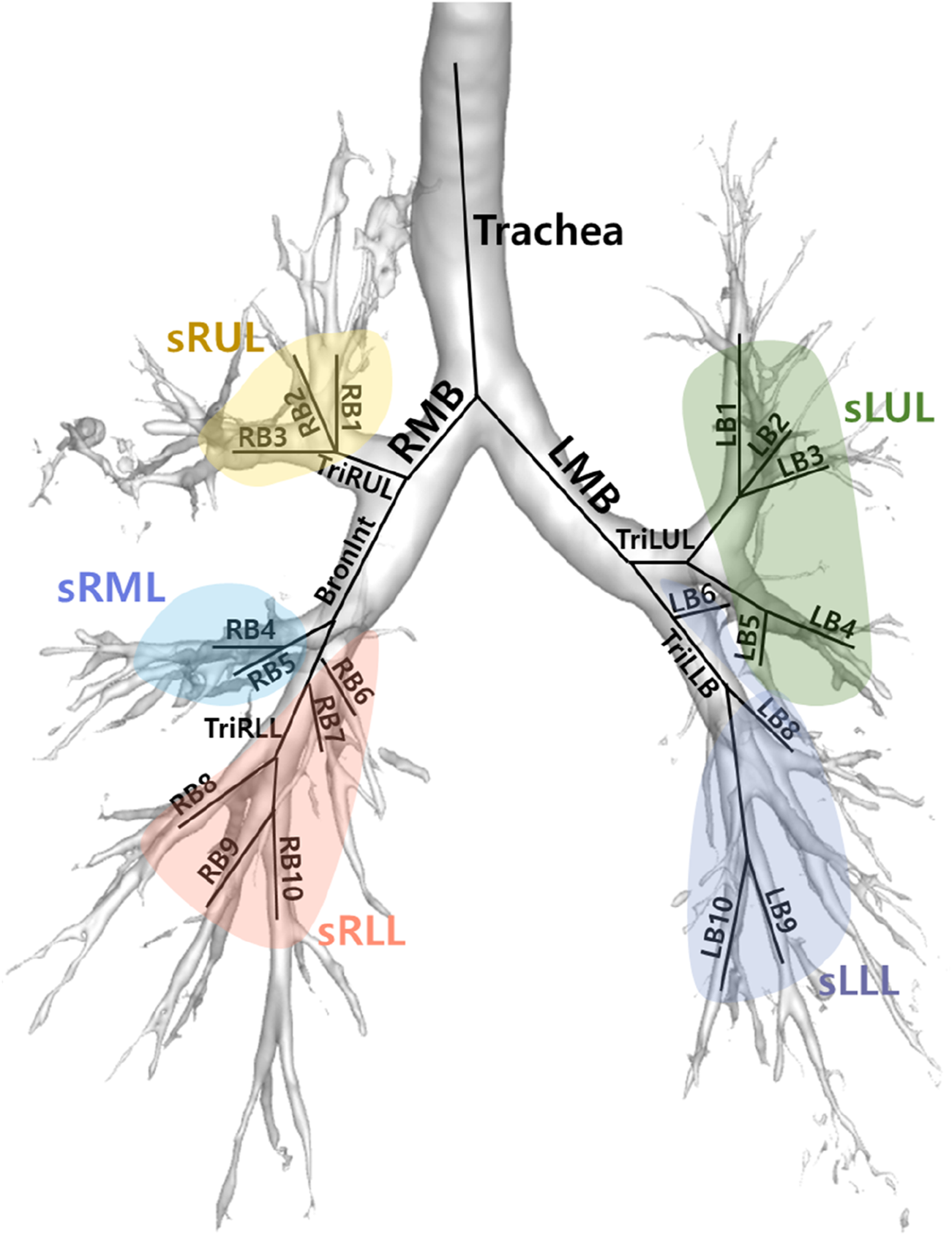 Diagram of a bronchial tree showing the trachea diverging into the right main bronchus (RMB) and left main bronchus (LMB). It highlights lobes of the lungs: superior right upper lobe (sRUL, yellow), superior right middle lobe (sRML, blue), superior right lower lobe (sRLL, red), superior left upper lobe (sLUL, green), and superior left lower lobe (sLLL, blue). Bronchial branches are labeled, including RB1 to RB10 on the right and LB1 to LB10 on the left.