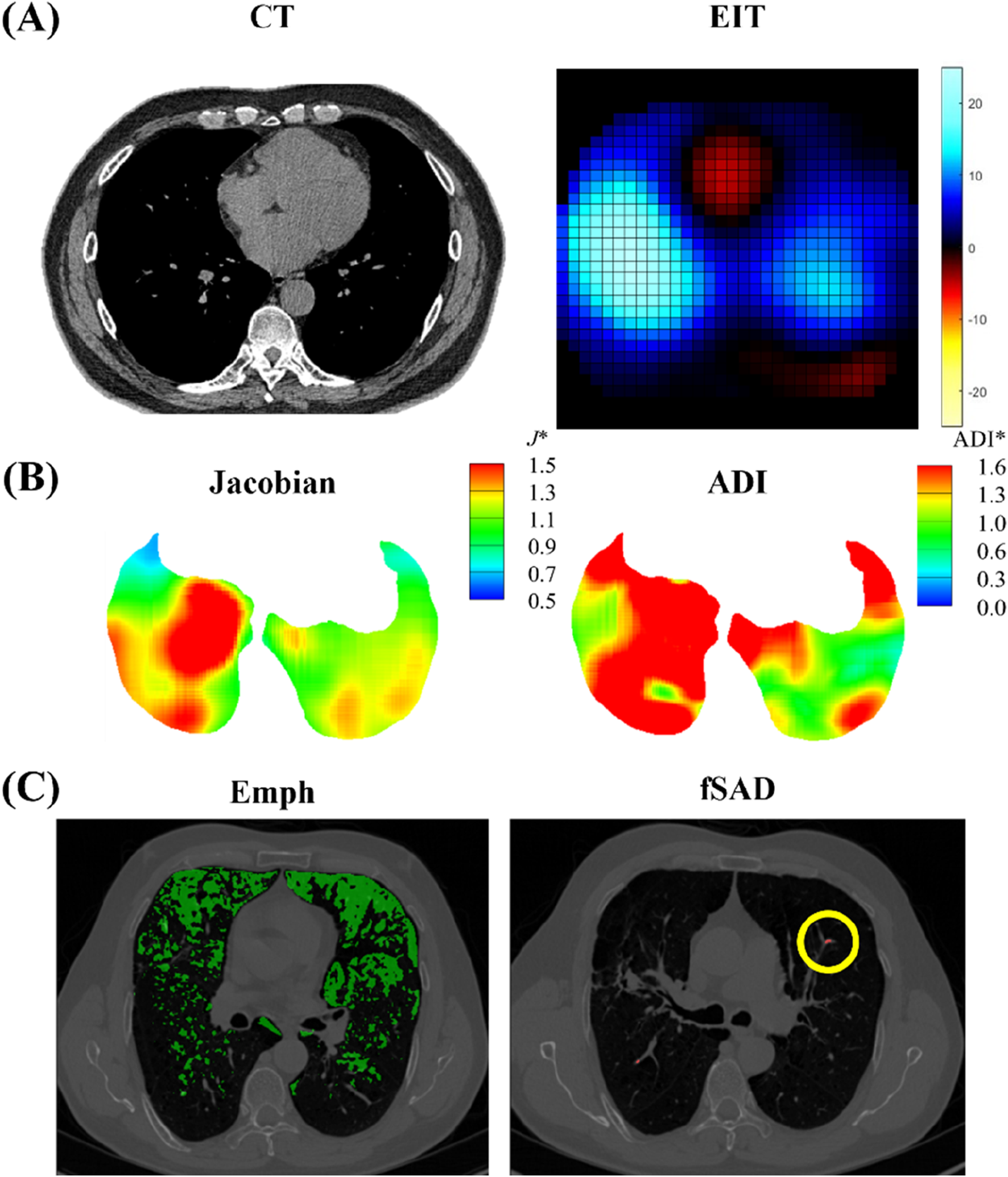 Panel A shows two images: a CT scan of the thorax on the left and an EIT map on the right with a color scale. Panel B depicts lung maps with Jacobian and ADI color-coded variations. Panel C includes two CT images: one labeled "Emph" shows green-highlighted emphysema areas, and the other labeled "fSAD" has a circled region indicating functional small airways disease.