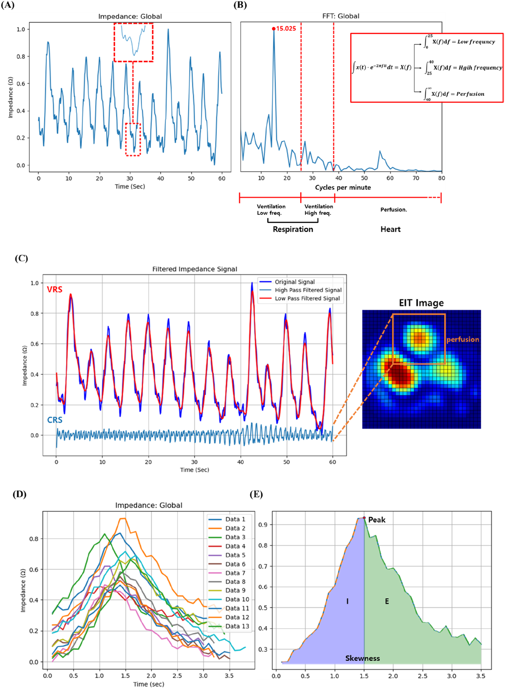 (A) Chart shows global impedance over time, highlighting variations in signal. (B) FFT graph depicts frequencies related to respiration and heart function, with equation inset. (C) Filtered impedance signal graph compares original, high-pass, and low-pass signals, linked to an EIT image showing perfusion. (D) Multiple datasets display impedance over time, showing variations among them. (E) Graph illustrates impedance with shaded regions marking peak, inspiration (I), and expiration (E), including skewness.