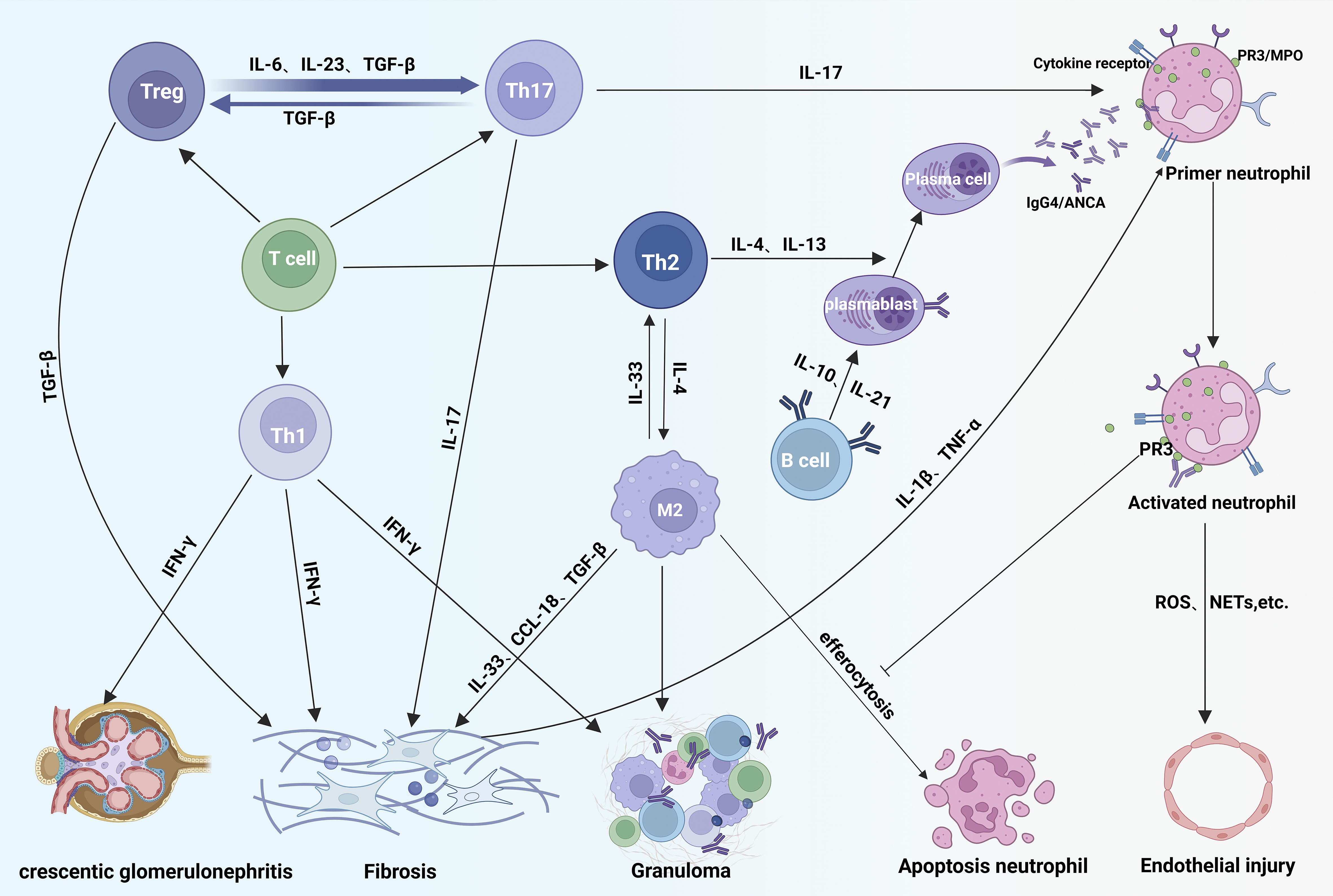 Cell signaling diagram in overlap syndrome illustrating interactions among including Treg, Th17, T cell, Th1, Th2, M2, B cell, and neutrophils. It shows pathways for cytokine signaling, leading to outcomes like crescentic glomerulonephritis, fibrosis, granuloma, apoptosis, and endothelial injury. Key cytokines include IL-6, IL-17, IL-4, IFNg, and TGF-b. Neutrophil activation and apoptosis are highlighted, along with interactions involving plasma cells and plasmablasts. The diagram visually represents immune responses and their pathological effects.