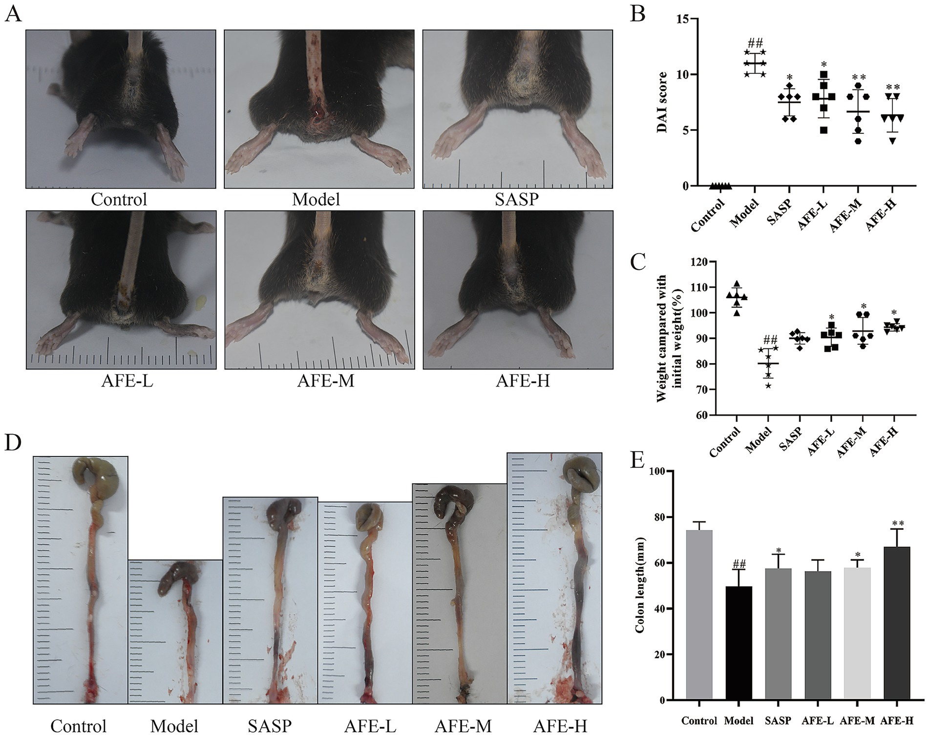 Six-panel scientific illustration showing the effects of different treatments on mice and their colons. Panel A displays photos of mouse hindquarters under six conditions: Control, Model, SASP, AFE-L, AFE-M, and AFE-H. Panels B and C contain graphs showing variations in DAI score and weight compared to initial weight, respectively, across treatments. Panel D shows images of colons under the same six conditions. Panel E presents a bar chart comparing colon length across treatments, indicating variations in response.