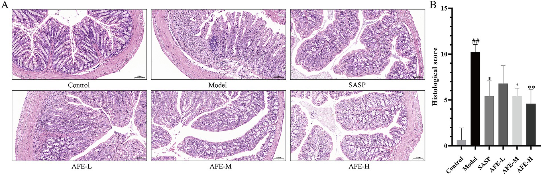 Panel A displays six histological slides of intestinal tissue under different conditions: Control, Model, SASP, AFE-L, AFE-M, and AFE-H. Panel B shows a bar graph comparing the histological scores across these conditions. The Model condition has the highest score, while the Control is the lowest. AFE variants display intermediate scores.