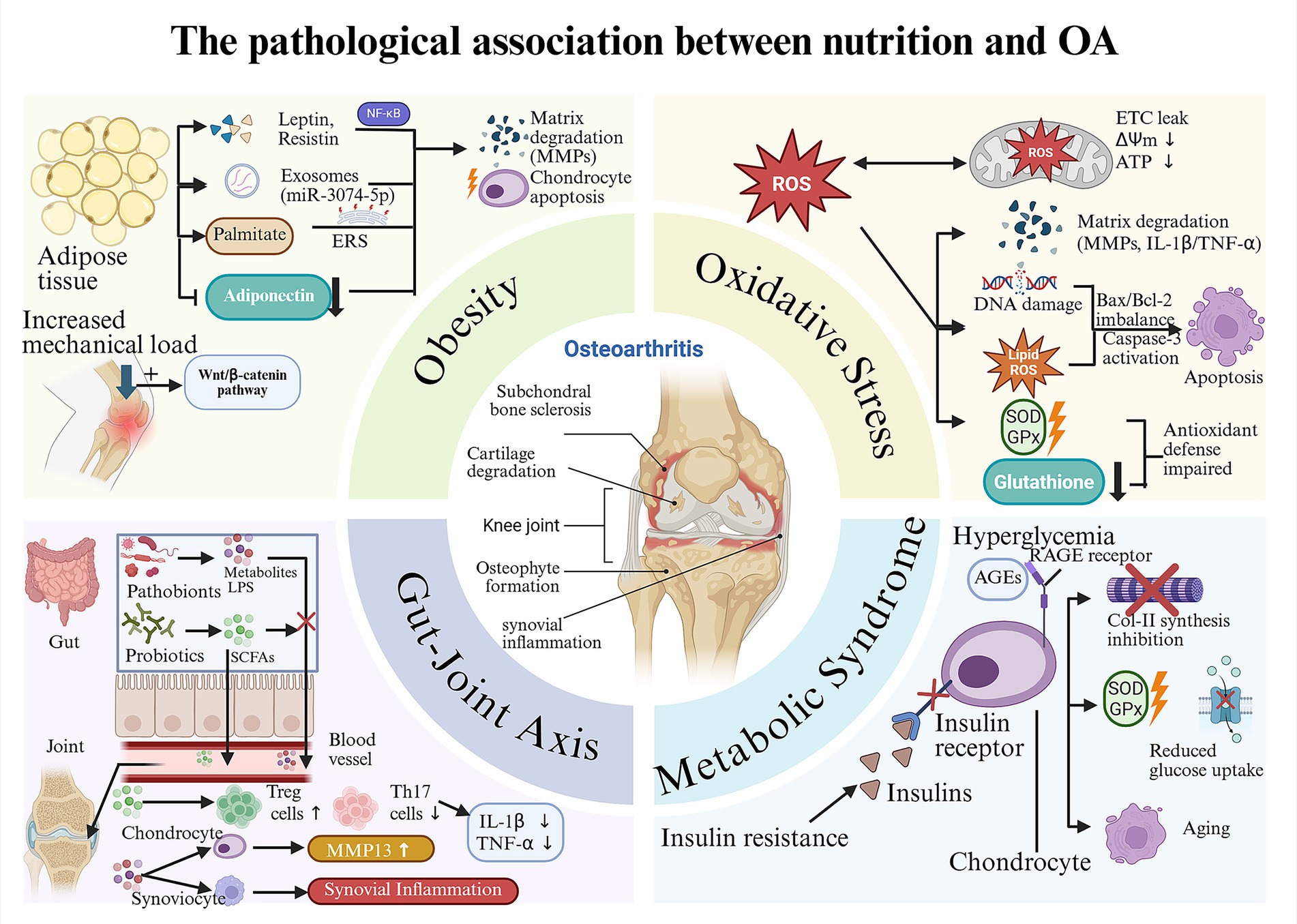 Diagram illustrating the pathological association between nutrition and osteoarthritis (OA). Central image of a knee joint indicates subchondral bone sclerosis, cartilage degradation, and osteophyte formation. Surrounding sections depict obesity, oxidative stress, gut-joint axis, and metabolic syndrome. Obesity is linked to adipose tissue, mechanical load, and pathways involving leptin and resistin. Oxidative stress involves reactive oxygen species (ROS), DNA damage, and impaired antioxidant defenses. Gut-joint axis highlights gut dysbiosis and inflammation. Metabolic syndrome shows hyperglycemia leading to insulin resistance and reduced glucose uptake in chondrocytes, contributing to OA progression.