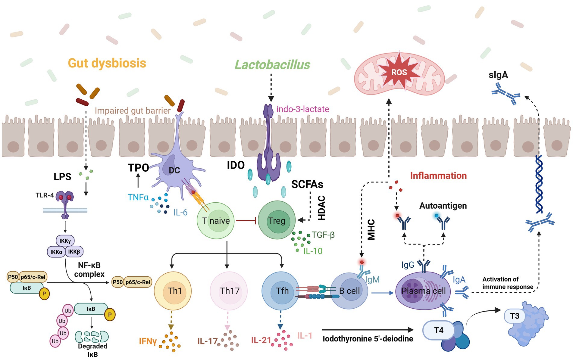 Diagram illustrating the complex interactions between gut dysbiosis and immune response. It includes components like LPS, NF-kB complex, T cells, B cells, and various cytokines. Highlighted pathways show TLR-4 activation, impaired gut barrier, production of IL-6, activation of Th1 and Th17 cells, and inflammation leading to autoantigen production. It also shows Lactobacillus influence, ROS, and the conversion of T4 to T3 via iodothyronine 5'-deiodinase, contributing to immune response activation.