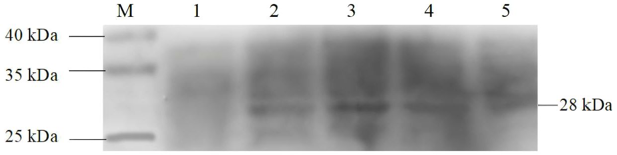 Western blot image displaying protein bands. Lanes labeled M, 1, 2, 3, 4, and 5 contain bands at molecular weights of 40 kDa, 35 kDa, 28 kDa, and 25 kDa. Lane M is likely a marker.