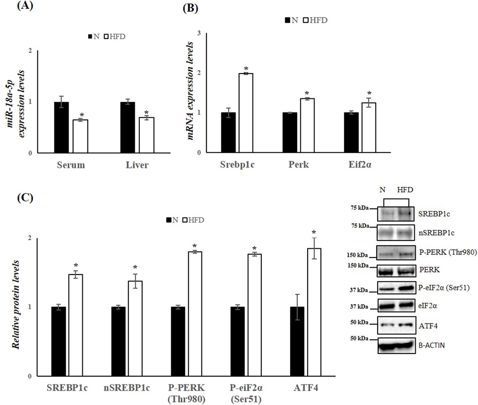 Bar charts and a Western blot image showing expression levels related to a normal diet (N) and high-fat diet (HFD). (A) miR-18a-5p levels decrease in both serum and liver with HFD. (B) mRNA levels for Srebp1c, Perk, and Eif2α increase with HFD. (C) Protein levels for SREBP1c, nSREBP1c, P-PERK (Thr980), P-eiF2α (Ser51), and ATF4 are higher with HFD. The blot image supports these findings with bands representing each protein. Statistical significance is marked with asterisks.