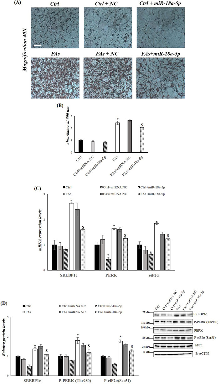Microscopic images, bar graphs, and protein expression data illustrating the effect of various treatments on cellular components. (A) Microscopic images at 40x magnification show differences under treatments Ctrl, Ctrl + NC, Ctrl + miR-18a-5p, FAs, FAs + NC, and FAs + miR-18a-5p. (B) A bar graph representing absorbance at five hundred nanometers under different conditions. (C) mRNA expression levels for SREBP1c, PERK, and eIF2α across the treatments. (D) Bar graph and Western blot analysis showing relative protein levels of SREBP1c, P-PERK (Thr980), and P-eIF2α (Ser51) with corresponding loading controls.