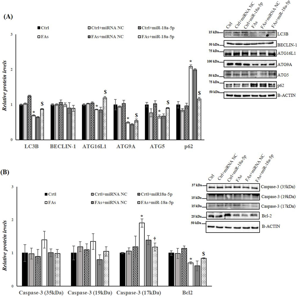 Bar graphs and Western blot images comparing protein levels. Panel A shows levels of LC3B, BECLIN-1, ATG16L1, ATG9A, ATG5, and p62 under different conditions. Panel B depicts Caspase-3 and Bcl2 levels. Blots validate bar graph data. Conditions include control, miRNA treatments, and fatty acids. Significant differences are marked with symbols.