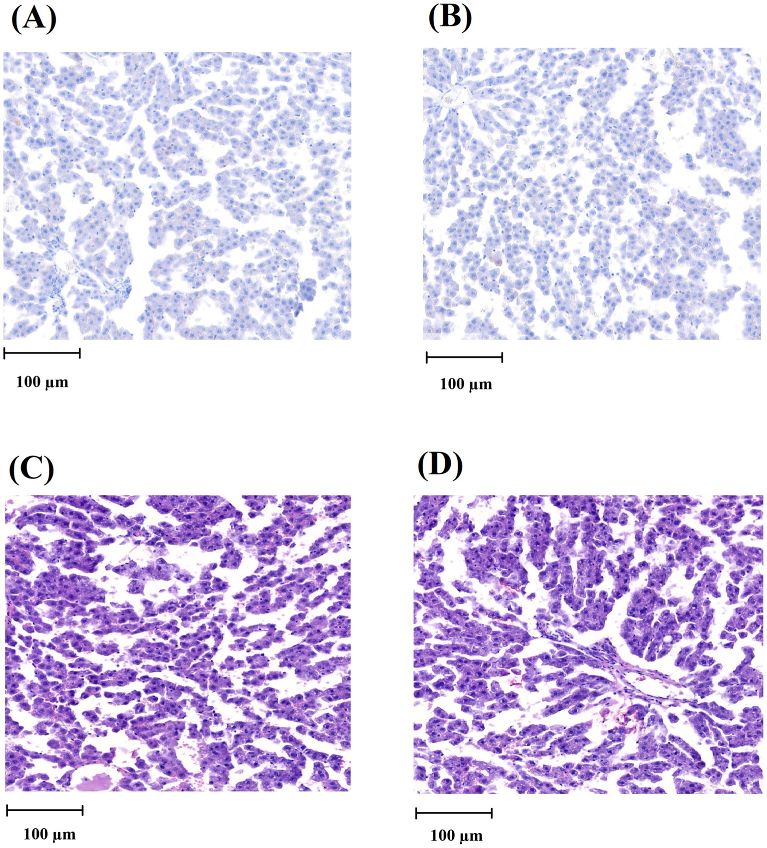 Histological images of tissue samples labeled A, B, C, and D. Samples A and B display lightly stained cells with scattered patterns. Samples C and D show densely stained cells with more defined structures. Each image includes a 100 micrometer scale bar for reference.
