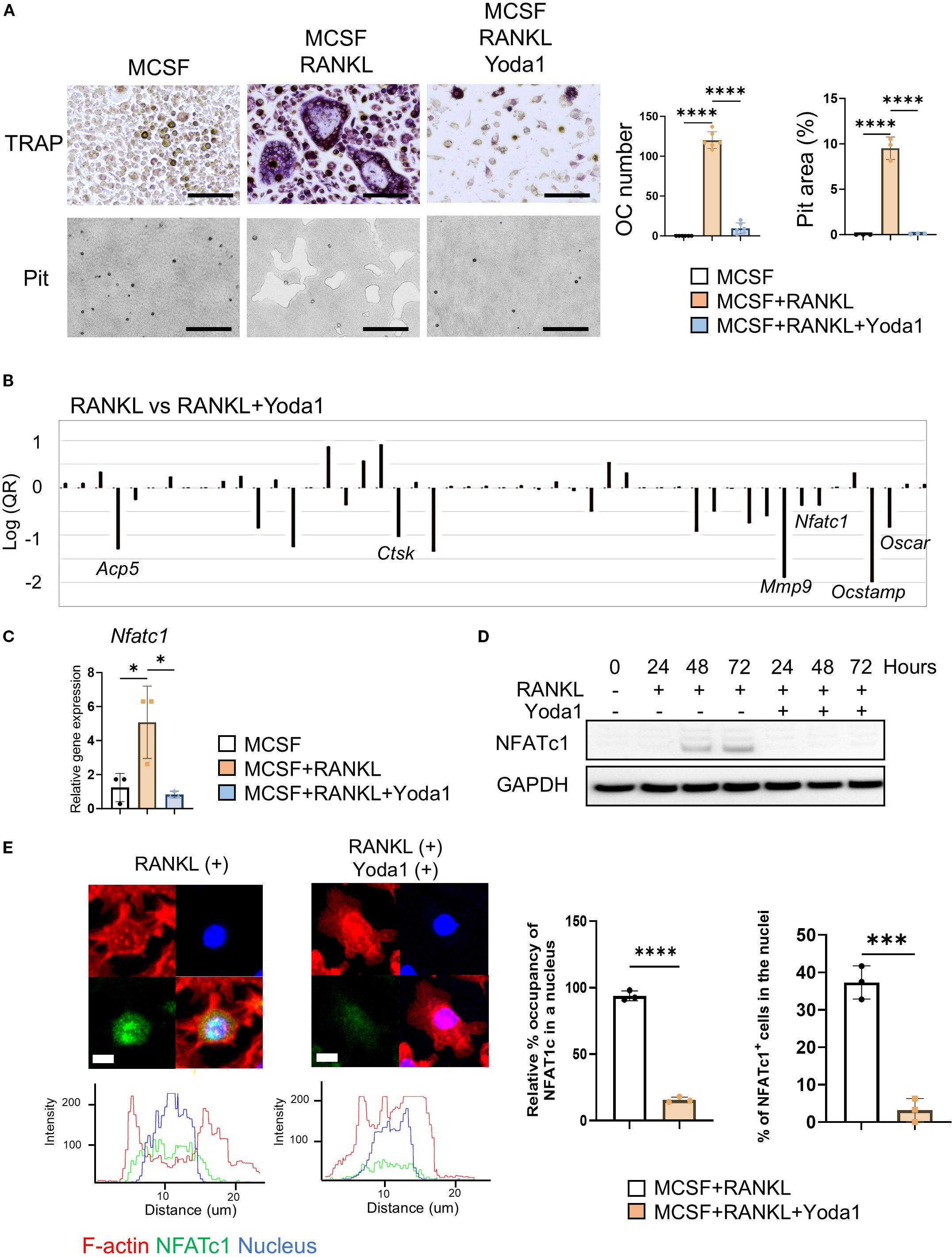 Composite image displaying various experiments related to the effects of RANKL and Yoda1. Panels include histological staining showing TRAP activity and pit formation under different conditions (MCSF, MCSF+RANKL, MCSF+RANKL+Yoda1), with bar graphs indicating osteoclast number and pit area. A gene expression bar graph compares RANKL vs. RANKL+Yoda1 treatments for specific genes. Additional panels show relative gene expression of Nfatc1, protein expression over time (Western blot of NFATc1 and GAPDH), and fluorescence microscopy images with graphs depicting the distribution of F-actin, NFATc1, and nucleus in osteoclasts under RANKL and RANKL+Yoda1 conditions. Quantitative graphs highlight NFATc1 nuclear occupancy and cell percentage.