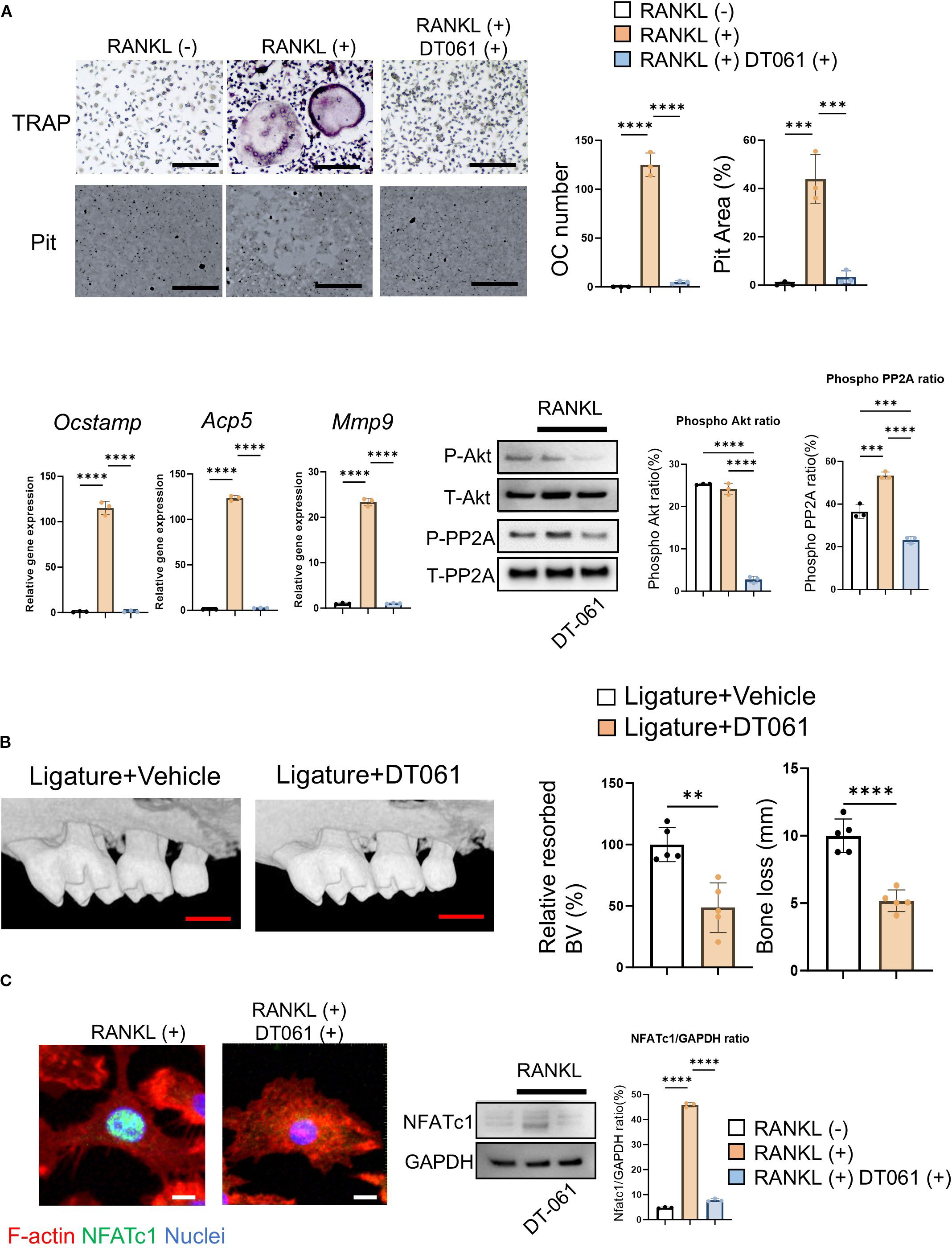 Graphical analysis of the effects of RANKL and DT061 on osteoclast activity and bone resorption. In section A, graphs and images show TRAP staining and pit formation assays, with bar charts indicating osteoclast numbers and pit area percentages under different conditions. Section B features images of mouse jaws treated with ligature plus vehicle or DT061, with bar charts showing relative bone volume resorption and bone loss. Section C includes fluorescent images of F-actin, NFATc1, and nuclei, with Western blot analysis and bar charts depicting NFATc1 and GAPDH ratios. Statistical significance is indicated with asterisks.