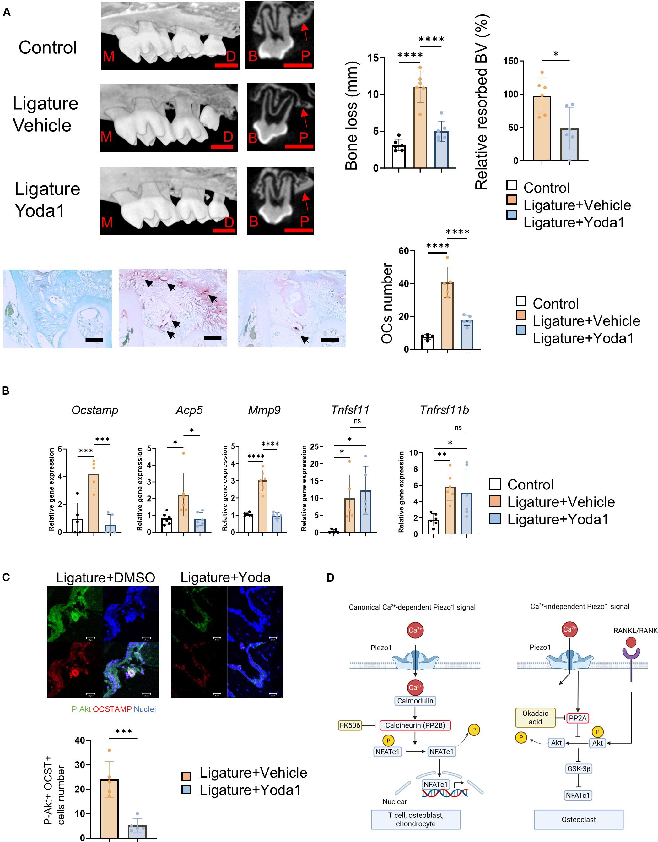 Scientific figure with four panels labeled A, B, C, and D. Panel A shows images of control, ligature+vehicle, and ligature+Yoda1 conditions, with graphs indicating bone loss and relative resorbed bone volume. Panel B presents bar graphs of gene expression for various markers, including Ocstamp and Acp5, under three experimental conditions. Panel C features fluorescent images of cells and a bar graph comparing P-Akt and OCSTAMP positive cell numbers. Panel D illustrates diagrams of calcium-dependent and independent Piezo1 signaling pathways, highlighting molecular interactions.